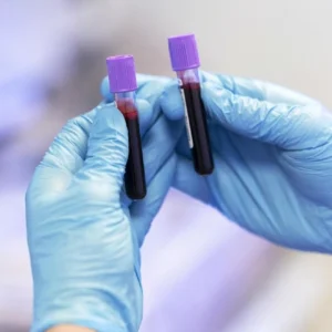 Perfil Metales Pesados