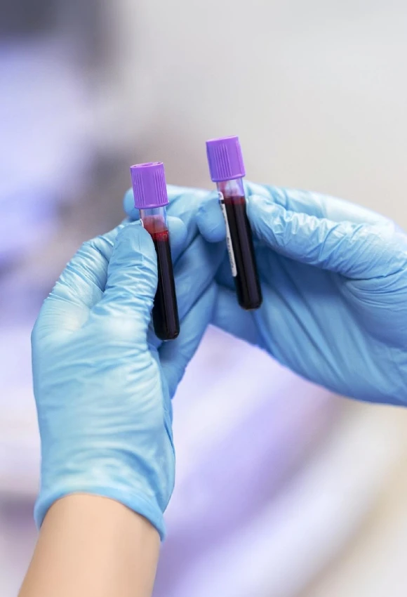 Perfil Metales Pesados